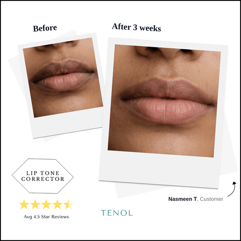 Lip Remedy Original  |  For Moderate Lip Discolouration