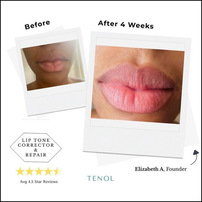 Two-Step Intensive Resurfacing & Correction Lip System