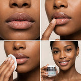 Exfoliating Lip Peel | Resurfacing Gel with 7% Lactic Acid