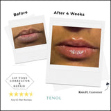 Two-Step Resurfacing & Corrective Lip Renewal System